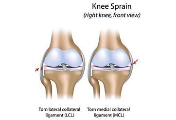 Knee Pain